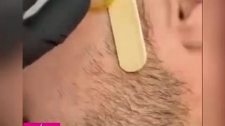 آنکارد ریش صورت آقایان