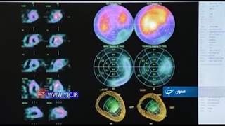 توان بالا در حوزه پزشکی هسته ای