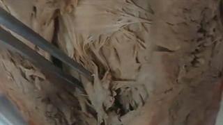 عملی قلب و عروق 7. پزشکی