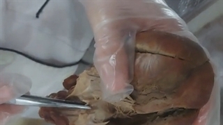 عملی قلب و عروق 8. پزشکی