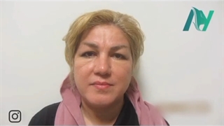 لیفت پیشانی و بلفاروپلاستی