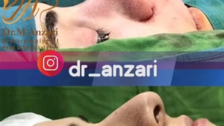 فیلم واقعی و بدون سانسور از اتاق عمل جراحی بینی