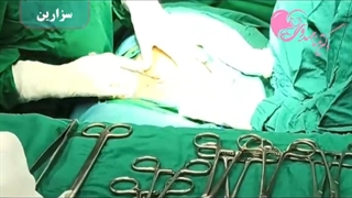 موضوع: جراحى سزارین بخش اول