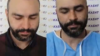 کلینیک کاشت مو vip تهران بهترین کلینیک کاشت مو