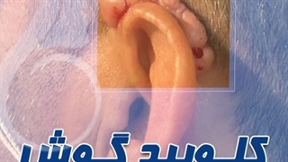 کلیوئید گوش