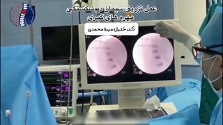 تزریق سیمان در شکستگی مهره های کمری