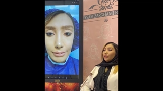 رضایت مشتری: ماندگاری تزریق چربی عالی بود برداشتن خال گوشتی