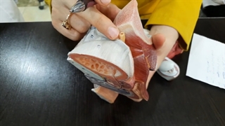 عملی تناسلی مردانه قسمت 2. پزشکی