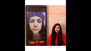 رضایت مشتری کاشت ابرو بدون جراحی در کلینیک ترانسپلنت