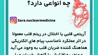 آریتمی و انواع آنها