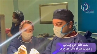 لیفت کامل ابرو و پیشانی همراه با تزریق چربی