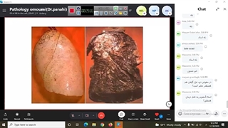 پاتولوژی عمومی جلسه ۲۱