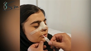 جراحی بینی گوشتی