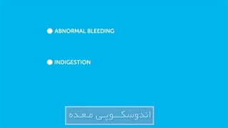 مراحل انجام آندوسکوپی