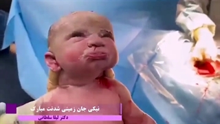تولد نیکی جان توسط دکتر لیلا سلطانی