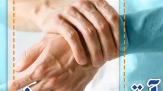 درباره آرتروز چه میدانید؟