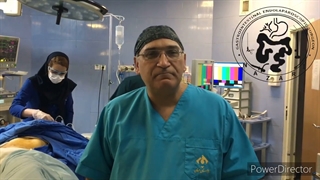 آشالازی نوعی اختلال نادر در حرکات مری است