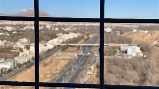 فلور نظری در شیراز پر کردن دندان