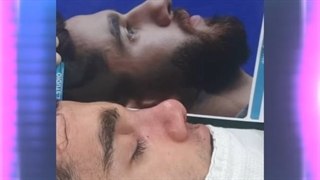 جراحی زیبایی بینی