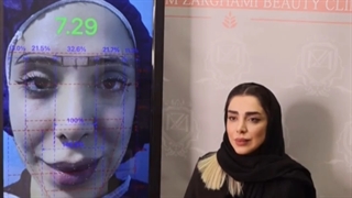 رضایت مشتری بدون عوارض کاشت ابرو در کلینیک ترانسپلنت