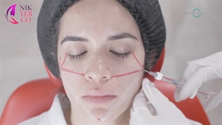 ژل رووفیل فاین برای زیر چشم