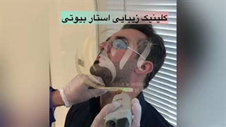 لیزرمو با دستگاه الکس کندلا امریکا ( کلینیک زیبایی استار بیوتی )