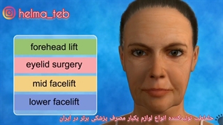 آشنایی با قسمت های لیفت کامل صورت