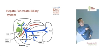 Dr Deepak Joshi - ERCP for PSC