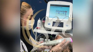 هایفوتراپی با پرقدرت ترین دستگاه موجود در ایران ( کلینیک زیبایی استار بیوتی )