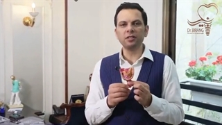 مراحل و مسیر انجام ایمپلنت دیجیتال