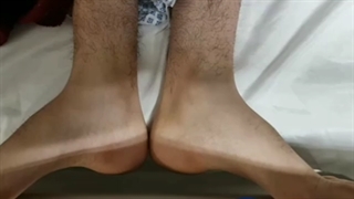 تعویض مفصل لگن