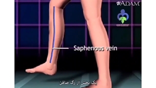 نحوه عمل قلب باز