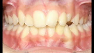 ارتودنسی.متخصص ارتودنسی تهران دکترعلیرضا خدیوی