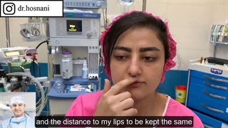 دو ماه بعد از عمل بینی