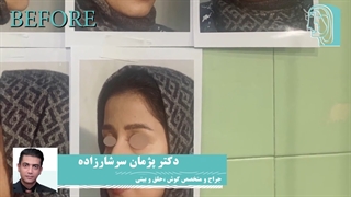 فیلم واقعی عمل بینی طبیعی در اتاق عمل