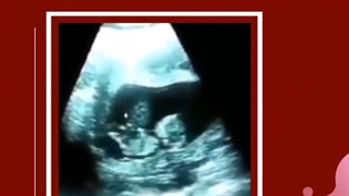 فیلم بازیگوشی جنین در رحم مادر