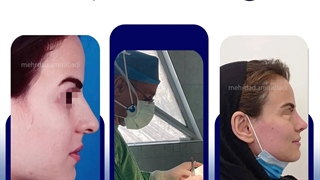 عمل بینی
