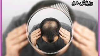 راهکارهای خانگی درمان ریزش مو بعد از کرونا
