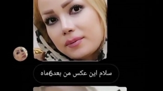 فرم بینی قبل از جراحی: استخوانی/ فرم بینی: فانتزی