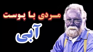مردی باپوست آبی!!