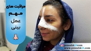 مهم ترین مراقبت های بعد عمل بینی چیست؟