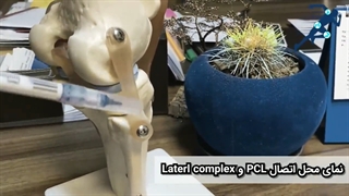 پارگی PCL  و PLC| دکتر شیروانی بختیاری