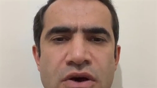 دکتر سید مجید حسینی: وجدان بیدار کاشت ابرو