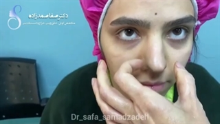 جراحی زیبایی بینی