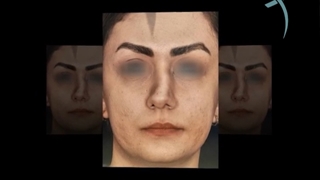 نمونه کار جراحی بینی