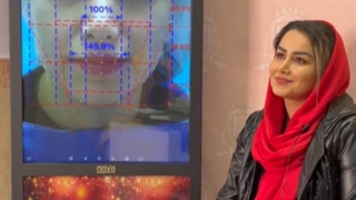 تزریق چربی به صورت به روش بایوفت کلینیک دندانپزشکی