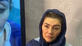 کاشت ابروی شگفت انگیز در کلینیک ترانسپلنت