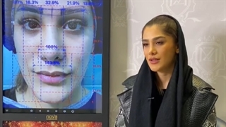 کاشت بدون عوارض کاشت ابرو در کلینیک ترانسپلنت