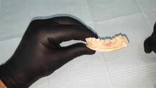 فیلم دندان مصنوعی تکی چسبی (کیفیت عالی)