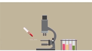 کلسترول چیست